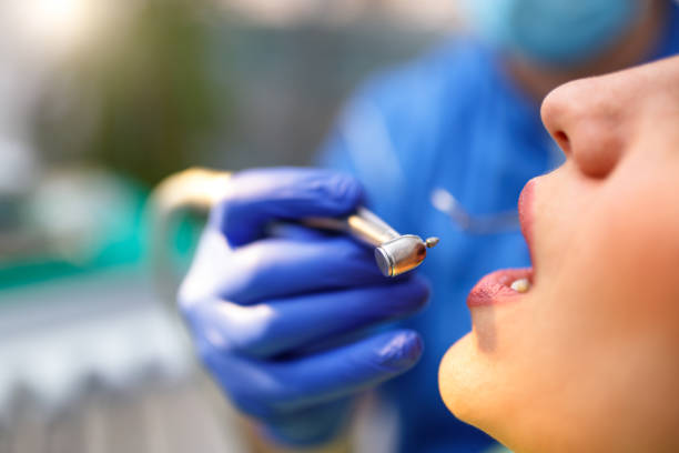 Dental Bonding in Mount Rainier, MD